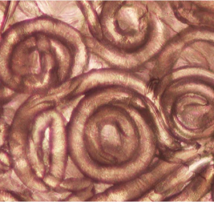 bacterias parecidas a gusanos vistas desde un microscopio