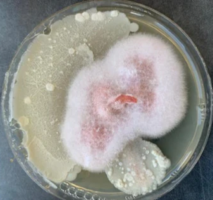 germen visto en una placa de petri